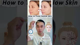 How to Treat Sallow Skinnaturalbeauty skincaretips skincaretips skinhealth [upl. by Fan]