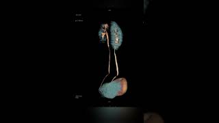 CT UROGRAPHY radiology radiologist viral radiographer mri imaging radiologylife [upl. by Danais]