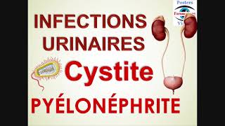 Infection renale Urinaire cystite pyélonéphrite chez enfant Symptômes Diagnostic Traitement [upl. by Betsey]