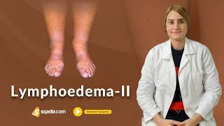 Lymphoedema II  General Surgery Video  Doctors Education  VLearning  sqadiacom [upl. by Dyoll]