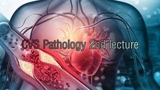 Rheumatic Fever and Infective endocarditis lecture [upl. by Hsepid]