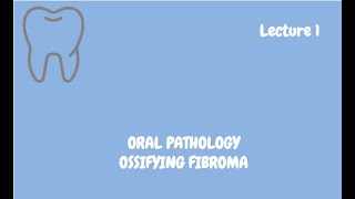 Ossifying Fibroma Complete Lecture  For NBDE NDEB MDS amp FCPS [upl. by Lesak]