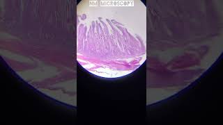 Unstriated smooth muscle tissue under microscope🔬youtubevideo [upl. by Eslehc]