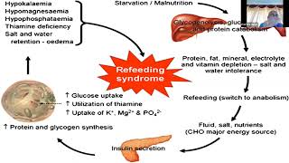 Refeeding Syndrome RFS Prof R K Singh Emergency Medicine SGPGI [upl. by Eirahcaz]