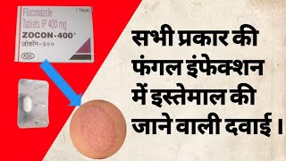 Zocon 400 mg tablet uses in hindidad ki dawai [upl. by Notlil]