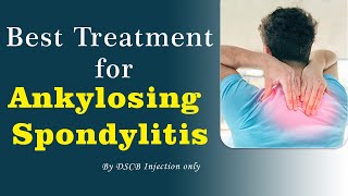 Ankylosing Spondylitis Best Treatment by DSCB Injection ankylosingspondylitis dscb drsunilsaini [upl. by Dorraj875]