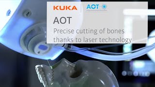 Robotic Bone Cutting with Cold Lasers [upl. by Acirre]