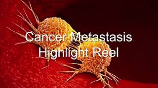 Cancer Metastasis Highlight Reel  Bioxytran BIXT Takes on Cancer [upl. by Etnomaj540]