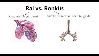 Ral vs Ronküs Patolojik Solunum Sesleri [upl. by Gnoh963]