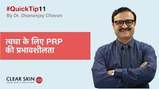 त्वचा के लिए पीआरपी की प्रभावशीलता Effectiveness of PRP for Skin  ClearSkinTips 11  In HINDI [upl. by Nnylesor991]