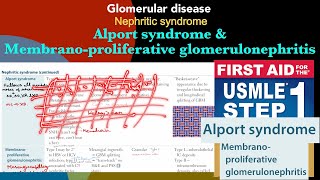 Alport syndrome amp Membranoproliferative glomerulonephritis in HindiUrdu by first aid for step 1 [upl. by Alyac]