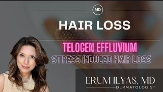 Telogen Effluvium  Stress Hair Loss [upl. by Garris]