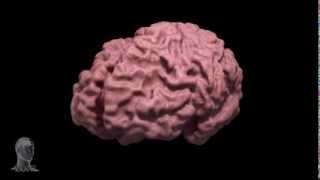 Alzheimers disease brain morph [upl. by Htiekram]