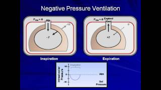 An Introduction to Mechanical Ventilation Mechanical Ventilation  Lecture 1 [upl. by Arlette]