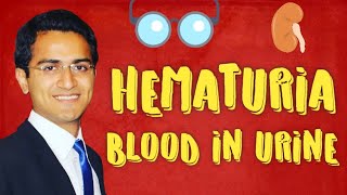 Hematuria Causes amp Diagnostic Workup of Blood in Urine [upl. by Atsiuqal]