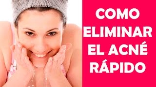 Como Eliminar el Acné Rápido de la Cara en 4 Pasos [upl. by Nihcas80]