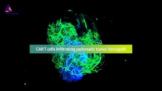 Revolutionizing the monitoring of CAR T cell therapies against solid tumors with the 3D imaging [upl. by Leziar966]