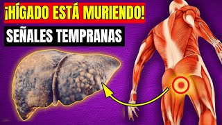 🚨 ¡8 Signos de que Tu Hígado ESTÁ MURIENDO ¡NO LAS IGNORES 🚨 [upl. by Tremaine484]