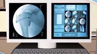 What to Expect during an Arthrogram procedure at RAYUS [upl. by Mcspadden960]