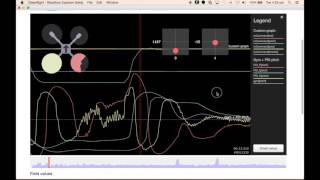 Quick Tutorial  Blackbox  A reasonably tuned axis [upl. by Kcered]