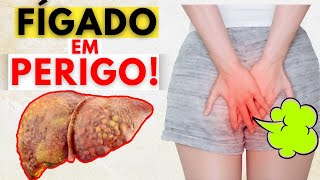 6 SINAIS DO SEU CORPO CAUSADOS PELO FÍGADO [upl. by Limak156]