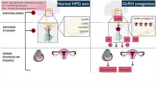 Gonadotropinreleasing hormone GnRH antagonists [upl. by Deedahs436]