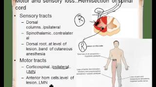 ipsilateral contralateral [upl. by Aihseuqram193]