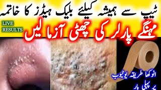 بلیک ہیڈز کا ہمیشہ کیلئے خاتمہ How To Remove BLACKHEADS Permanently From Nose ampFace 💯 Naturally Home [upl. by Nimesay122]