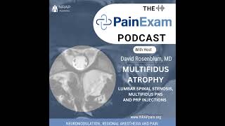 Multifidus Atrophy Multifidus Stimulation Peripheral Nerve Stimulation amp Leukocyte Rich PRP [upl. by Enovi]