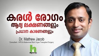 കരൾ രോഗത്തിന്റെ ഈ ലക്ഷണങ്ങൾ സൂക്ഷിക്കുക  Liver Disease Malayalam Health Tips [upl. by Acul]