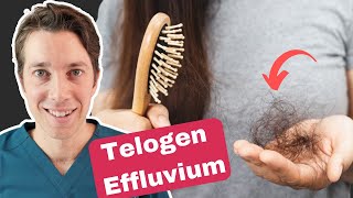 Telogen Effluvium Explained  Best Hair Shedding Treatments [upl. by Iew]