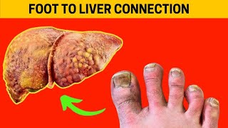 How Your Feet Are Warning You About Your Liver Problems [upl. by Enaffit]