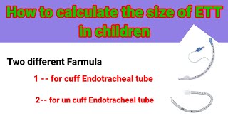 Endotracheal tube size calculation in children anaesthesiawithbabar2576 [upl. by Normi411]