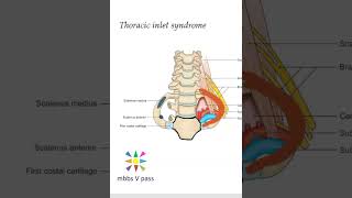 Anatomy Thorax 214 Thoracic inlet syndrome viva [upl. by Oam]