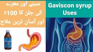 Gaviscon syrup uses in Urdu [upl. by Cristionna]