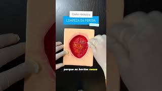 APRENDA A LIMPAR A FERIDA EM 1 minuto tecnicosdeenfermagem medicina enfermagem shorts [upl. by Ecnesse868]