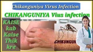 Chikungunya Prevention and Treatment  Chikungunya Virus infection  Chikungunya Treatment Recovery [upl. by Aluino]