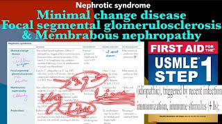 Minimal change disease Focal segmental glomerulosclerosis amp Membranous nephropathy in HindiUrdu [upl. by Nakeber]