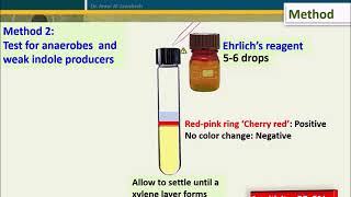 Indole test [upl. by Hicks]