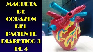 MAQUETA DE CORAZON DEL PACIENTE DIABETICO 3 DE 4 [upl. by Yeung125]