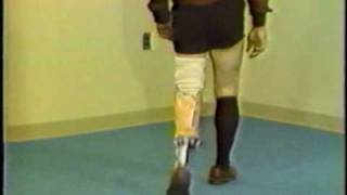 Gait deviations relating to a transtibial prosthesis [upl. by Cecilius]