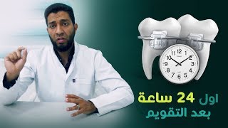 تقويم الأسنان و أول 24 ساعه بعد التقويم  د\ مصطفى الشيتي [upl. by Haraj]