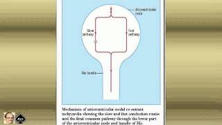 ECG tutorial Basic principles of ECG analysis Pediatric ECG 006 [upl. by Merrel]