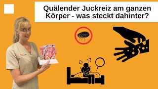 Skabies Quälender Juckreiz am ganzen Körper durch die Krätzmilbe [upl. by Neehcas]