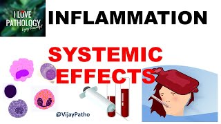 INFLAMMATION Part 10 Systemic effects of Inflammation [upl. by Zashin935]