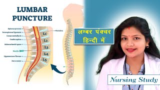 Lumbar Puncture Spinal Tap Procedure  Hindi Nursing Study [upl. by Eltsyrc169]