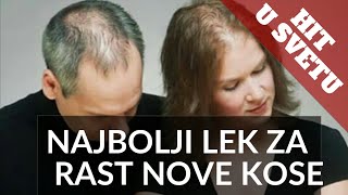 prp u lečenju opadanja kose alopecije areate i androgene alopecije [upl. by Anihta]