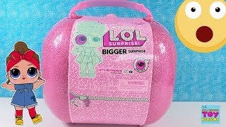 LOL Bigger Surprise Limited Edition Doll Unboxing 60 Surprises Inside  PSToyReviews [upl. by Yellat166]