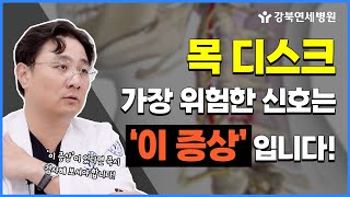 목디스크 가장 위험한 증상은 이 증상 입니다😲 l 목디스크의 대표적인 증상들과 치료 방법에 대해 알아보자 강북연세 TV [upl. by Norat]