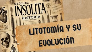 Litotomía y su evolución Medicina Insólita increíble pero real [upl. by Amesari411]